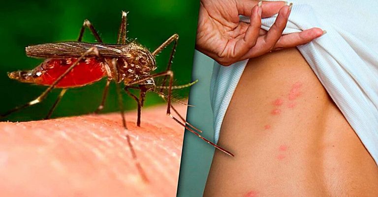 Voici pourquoi les moustiques sont attirés par des personnes plus que d’autres