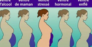 5 types de ventre et comment s’en débarrasser