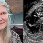 Cette femme de 42 ans est enceinte de triplés, elle accouche de quadruplés